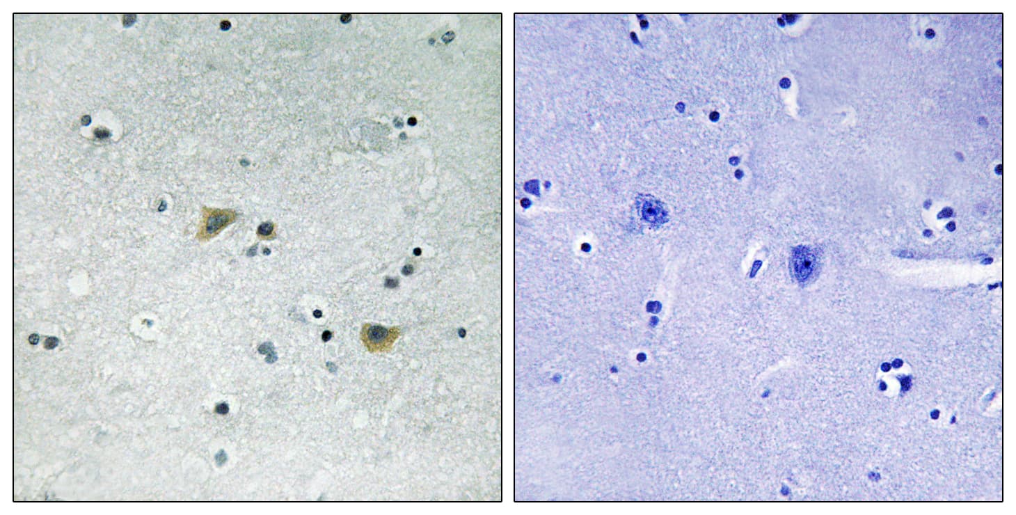 SRC Antibody (phospho-Ser75)