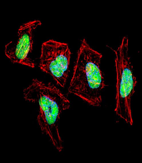 Polyclonal Rabbit anti-Human NFI / NFIC Antibody (aa180-208, IF, WB)