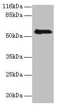 RBMY1F Antibody (aa1-496)