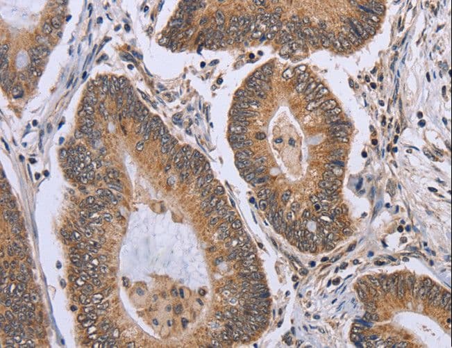 Polyclonal Rabbit anti-Human ERCC6L / FLJ20105 Antibody (IHC)