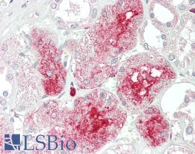 IHC-plus™ Polyclonal Rabbit anti-Human PDZD3 Antibody (aa119-435, IHC, WB)
