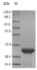Mouse Lcn5 / Lipocalin 5 Protein (Recombinant 6His, N-terminus)