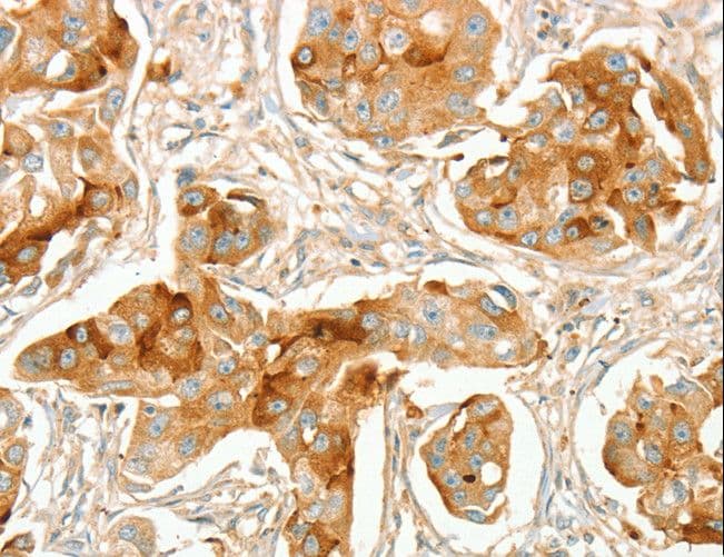 ACE / CD143 Antibody