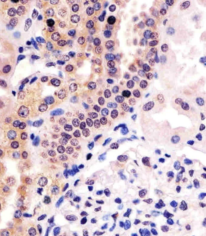 PHC3 Antibody (aa819-850)