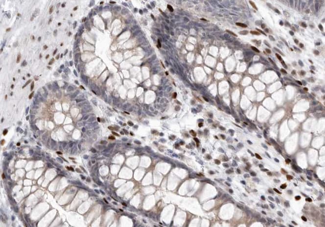 CLDN3 / Claudin 3 Antibody