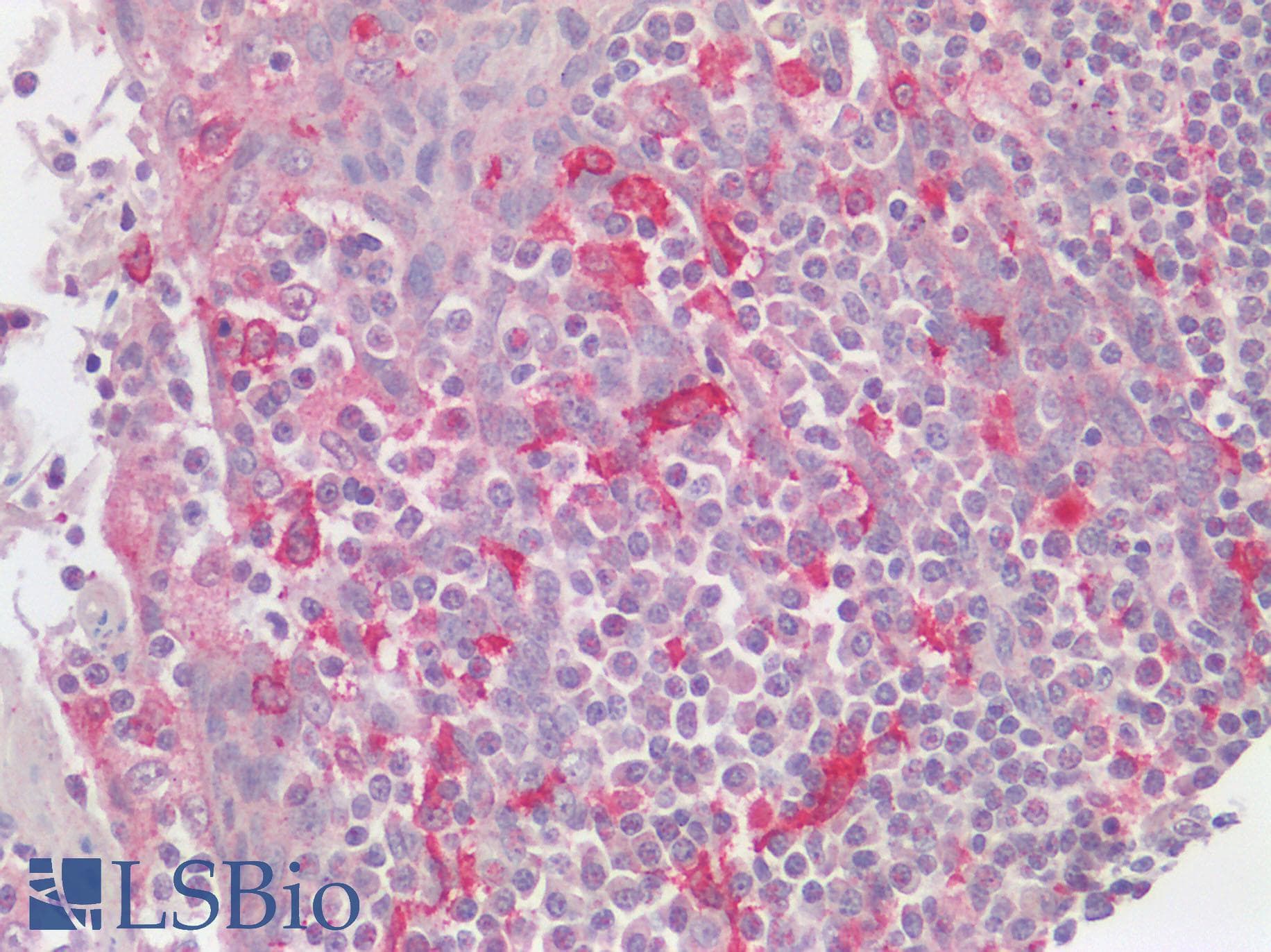 IHC-plus™ Polyclonal Rabbit anti-Human AIF1 / IBA1 Antibody (N-Terminal, IHC)