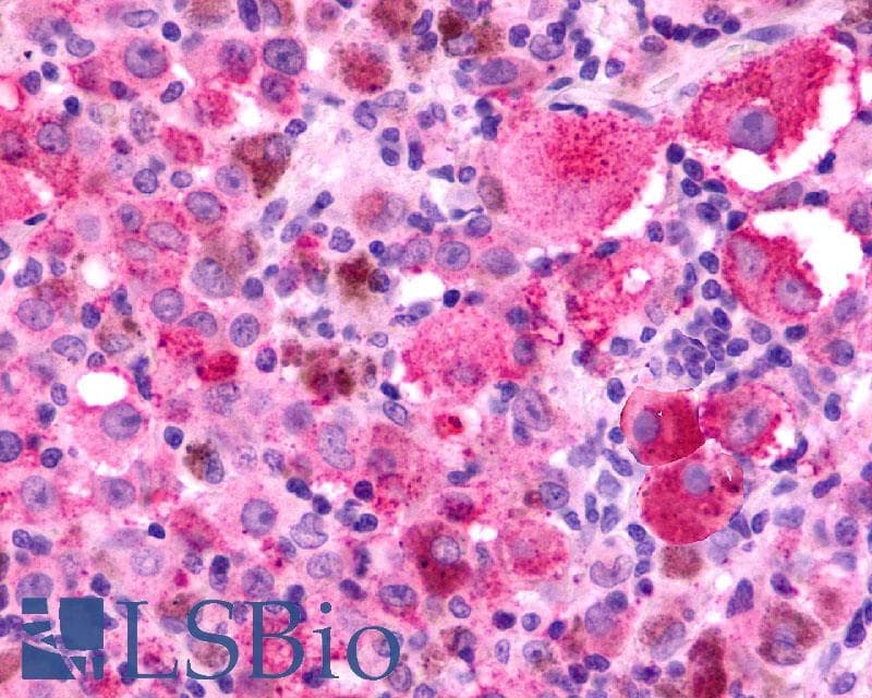 PathPlus™ Polyclonal Rabbit anti-Human CXCR2 Antibody (Extracellular Domain, IHC)