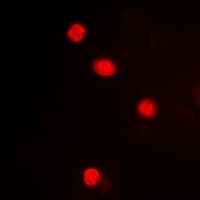Polyclonal Rabbit anti-Human MAPKAPK3 Antibody (C-Terminus, IHC, IF, WB)