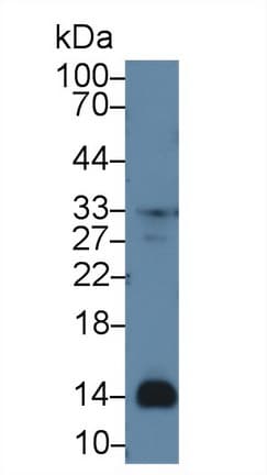 CXCL7 / PPBP Antibody (Cy3)