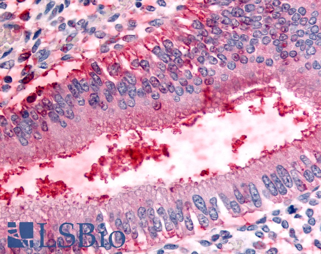 IHC-plus™ Dipeptidylpeptidase 8 / DPP8 Antibody (Internal)