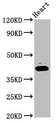 Polyclonal Rabbit anti-Human NSDHL Antibody (IHC, IF, WB)