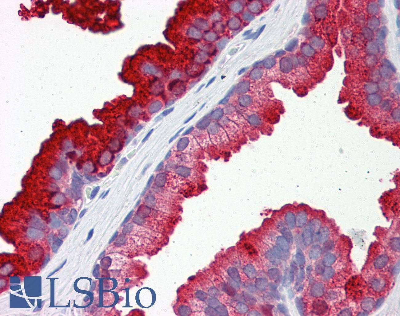 Polyclonal Rabbit anti-Human RAB23 Antibody (aa35-84, IHC, WB)