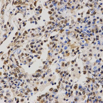 Polyclonal Rabbit anti-Human Histone H4 Antibody (Asym-Di-Methyl-Arg3, IHC, IF, WB)
