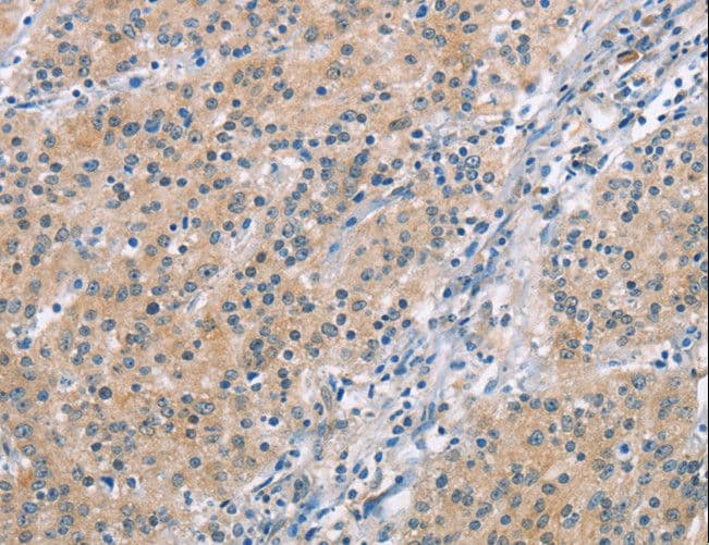 MCL1 / MCL 1 Antibody