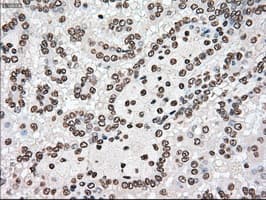 Monoclonal Mouse anti-Human TYRO3 Antibody (clone OTI2G2, IHC, WB)
