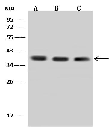 Aprataxin / APTX Antibody