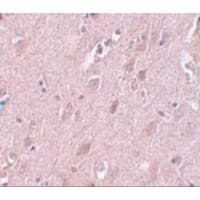 ZC3H12B Antibody