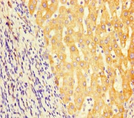 GCD / GCDH Antibody