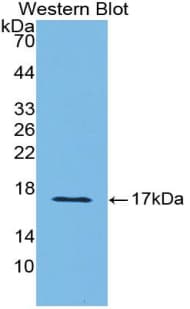 SEMA3A / Semaphorin 3A Antibody (aa31-150)
