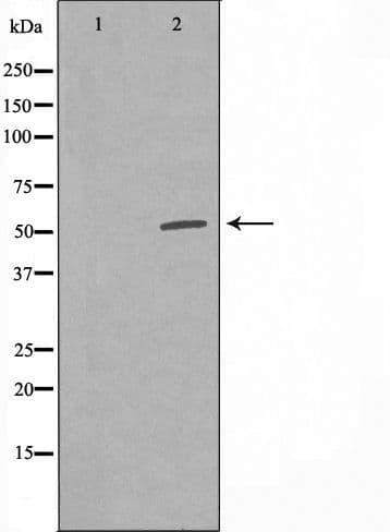 DNTT / TdT Antibody