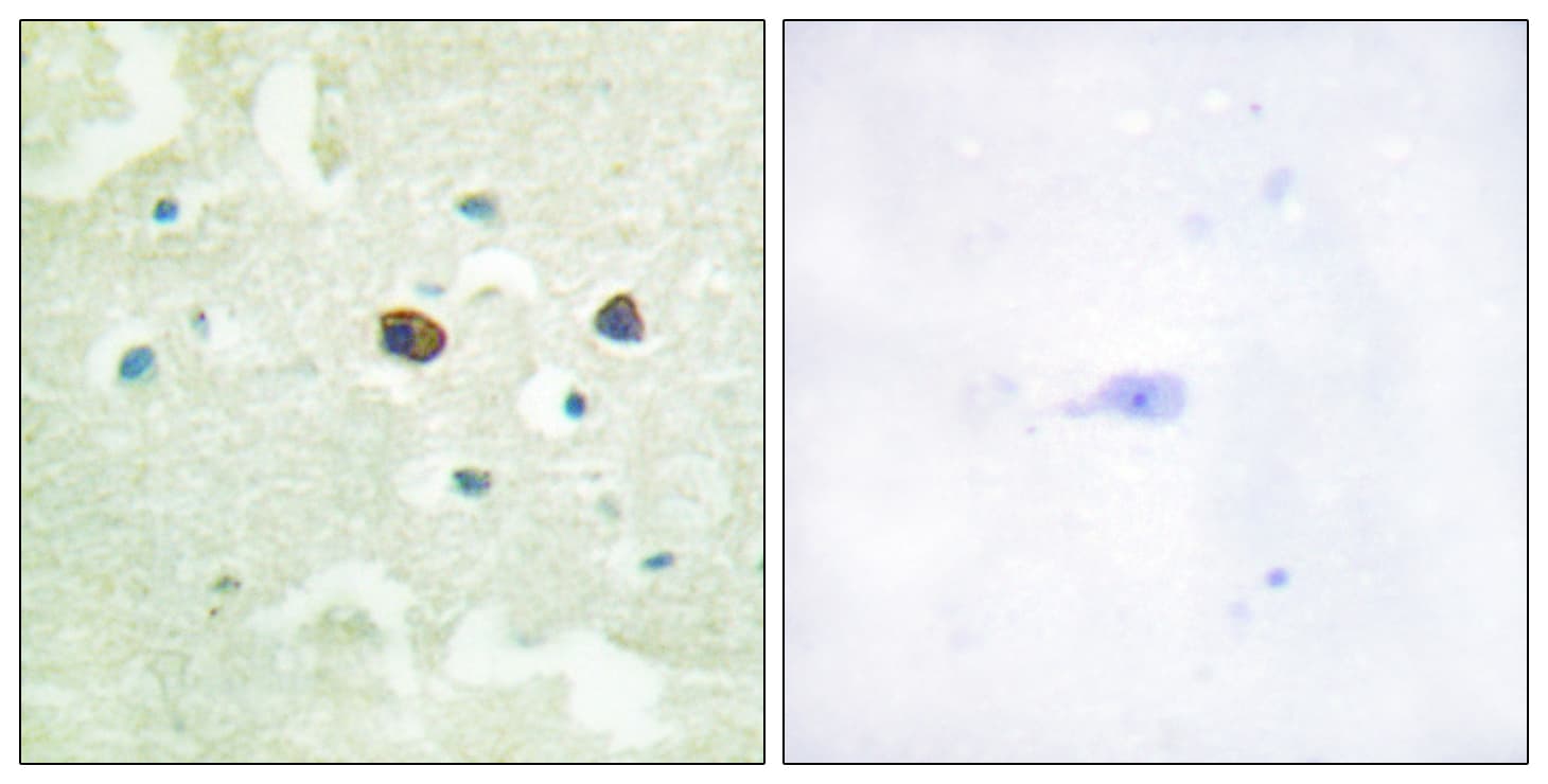 Polyclonal Rabbit anti-Human PTP1B Antibody (phospho-Ser50, IHC, WB)
