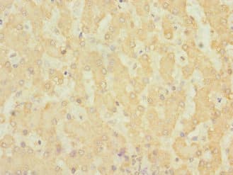 Polyclonal Rabbit anti-Human ADGRG6 / GPR126 Antibody (IHC)