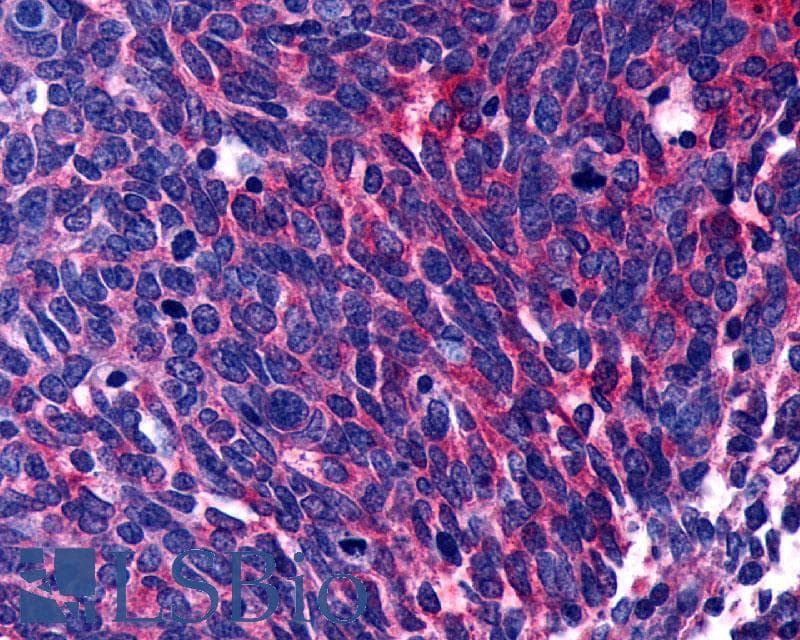 PathPlus™ Polyclonal Rabbit anti-Human LPAR3 / LPA3 / EDG7 Antibody (Cytoplasmic Domain, IHC)