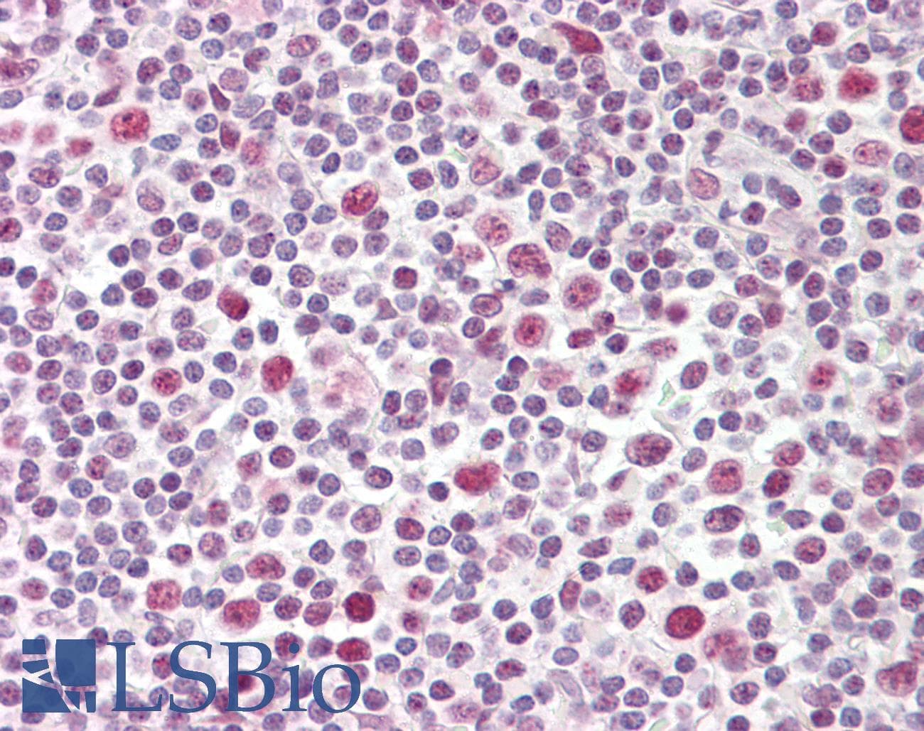 IHC-plus™ TCF19 / TCF-19 Antibody (aa259-274)