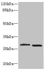 CRYBB1 Antibody