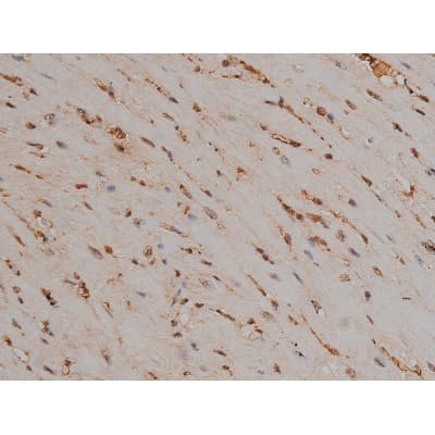 MAPT / Tau Antibody (phospho-Thr231)