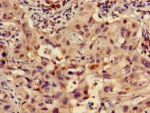 Polyclonal Rabbit anti-Human RPS15 / Ribosomal Protein S15 Antibody (IHC, IF, WB)
