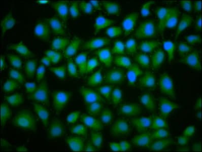 UBE2D2 / UBCH5B Antibody