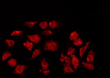 NR3C1/Glucocorticoid Receptor Antibody (phospho-Ser211)