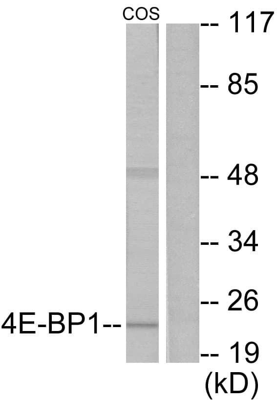 PathPlus™ EIF4EBP1 / 4EBP1 Antibody (aa35-84)