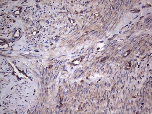 GARS / Glycyl tRNA Synthetase Antibody (clone OTI4G4)