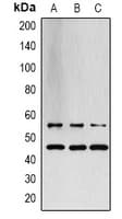 SAPK / JNK / MAPK8 + MAPK9 + MAPK10 Antibody (Internal)