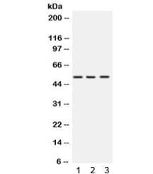 SPTLC1 / HSN1 Antibody