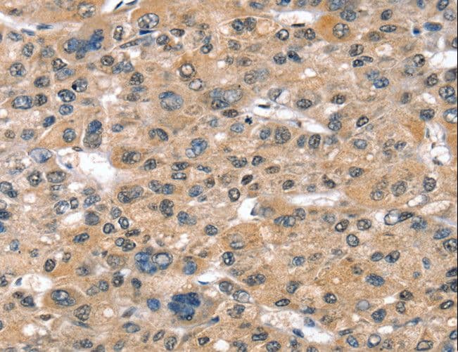 Polyclonal Rabbit anti-Human SULT1B1 / Sulfotransferase 1B1 Antibody (IHC, WB)