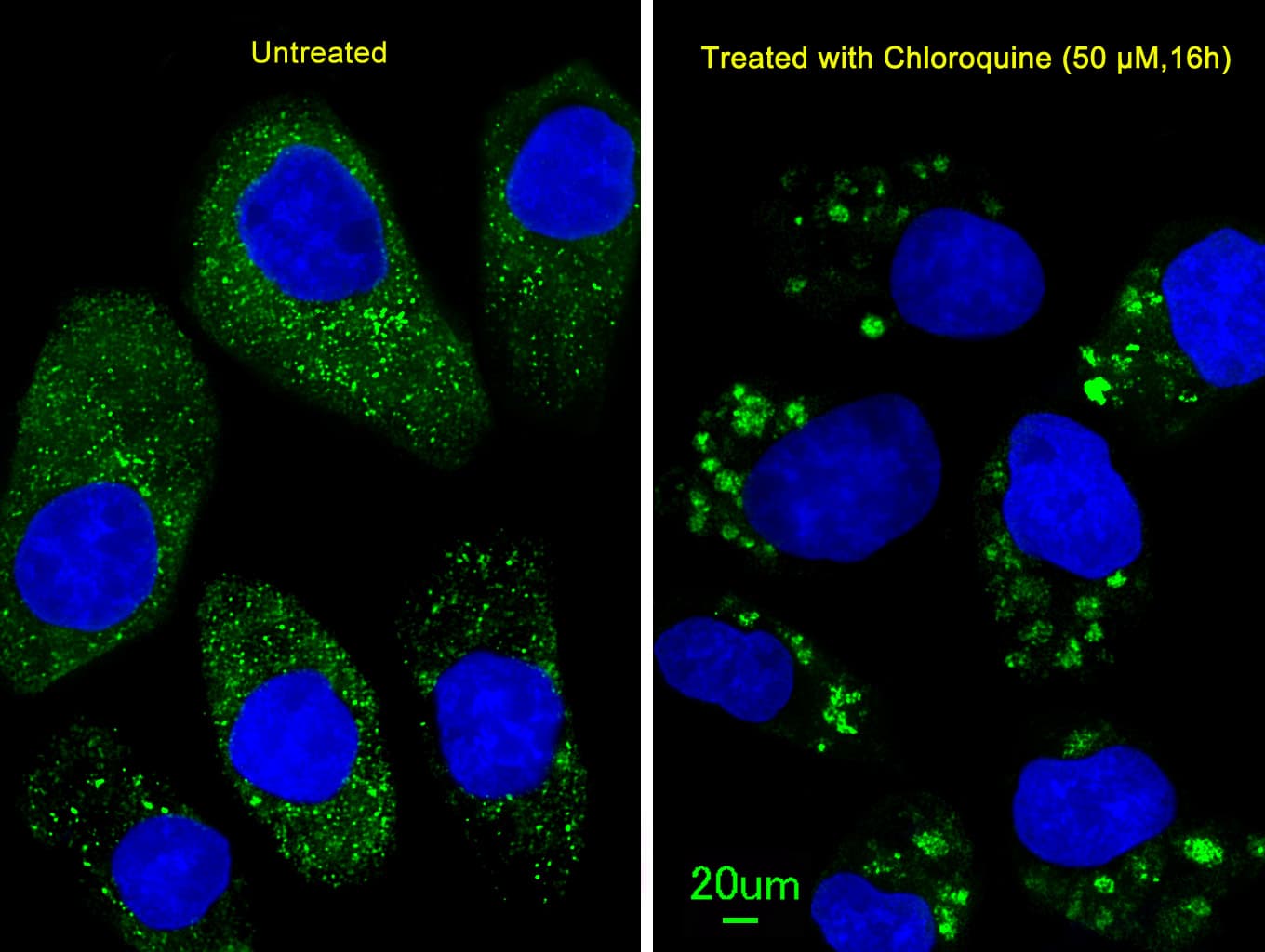 Polyclonal Rabbit anti-Human MAP1LC3B / LC3B Antibody (aa1-30, IHC, IF, WB)