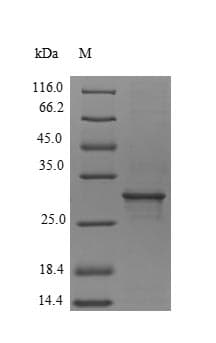 Apium graveolens Api g 1, Isoallergen 2 Protein (Recombinant 6His-SUMO, N-terminus)