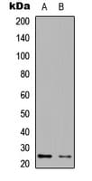 Polyclonal Rabbit anti-Human EIF4E3 Antibody (Internal, WB)