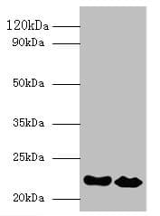 IFNA21 / Interferon Alpha 21 Antibody