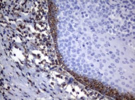 Monoclonal Mouse anti-Human PIK3CD / PI3K Delta Antibody (clone OTI1B5, aa286-610, IHC, WB)