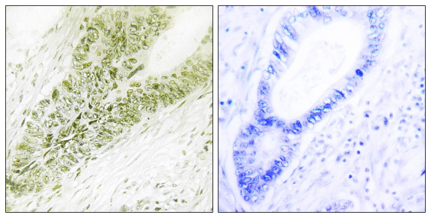Polyclonal Rabbit anti-Human UBN1 / Ubinuclein 1 Antibody (IHC, IF)