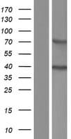 ACBD4 Protein (Over-Expression Lysate Myc-DDK (Flag))