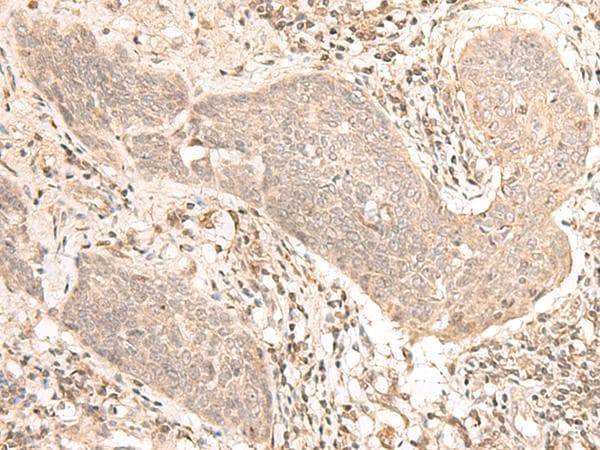 CCDC132 Antibody