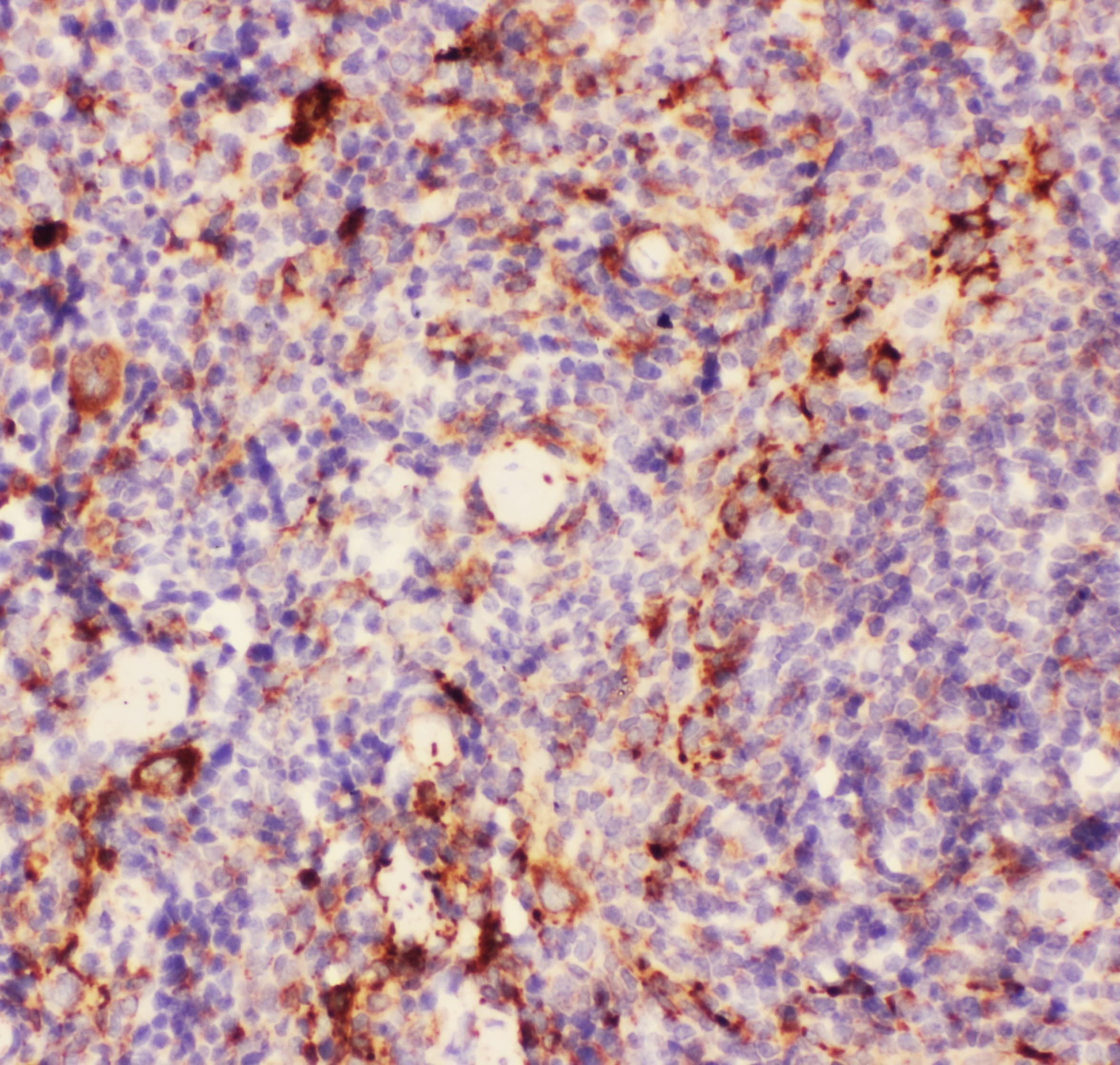 ITGAM / CD11b Antibody (aa17-382)