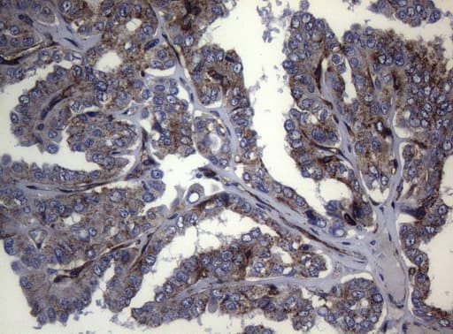 CTSL / Cathepsin L Antibody (clone OTI6B8)