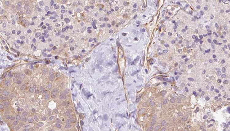 Polyclonal Rabbit anti-Human UBE2E2 / UBCH8 Antibody (IHC, WB)