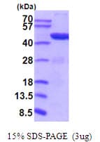 Mouse PGK1 / Phosphoglycerate Kinase Protein (Recombinant His)